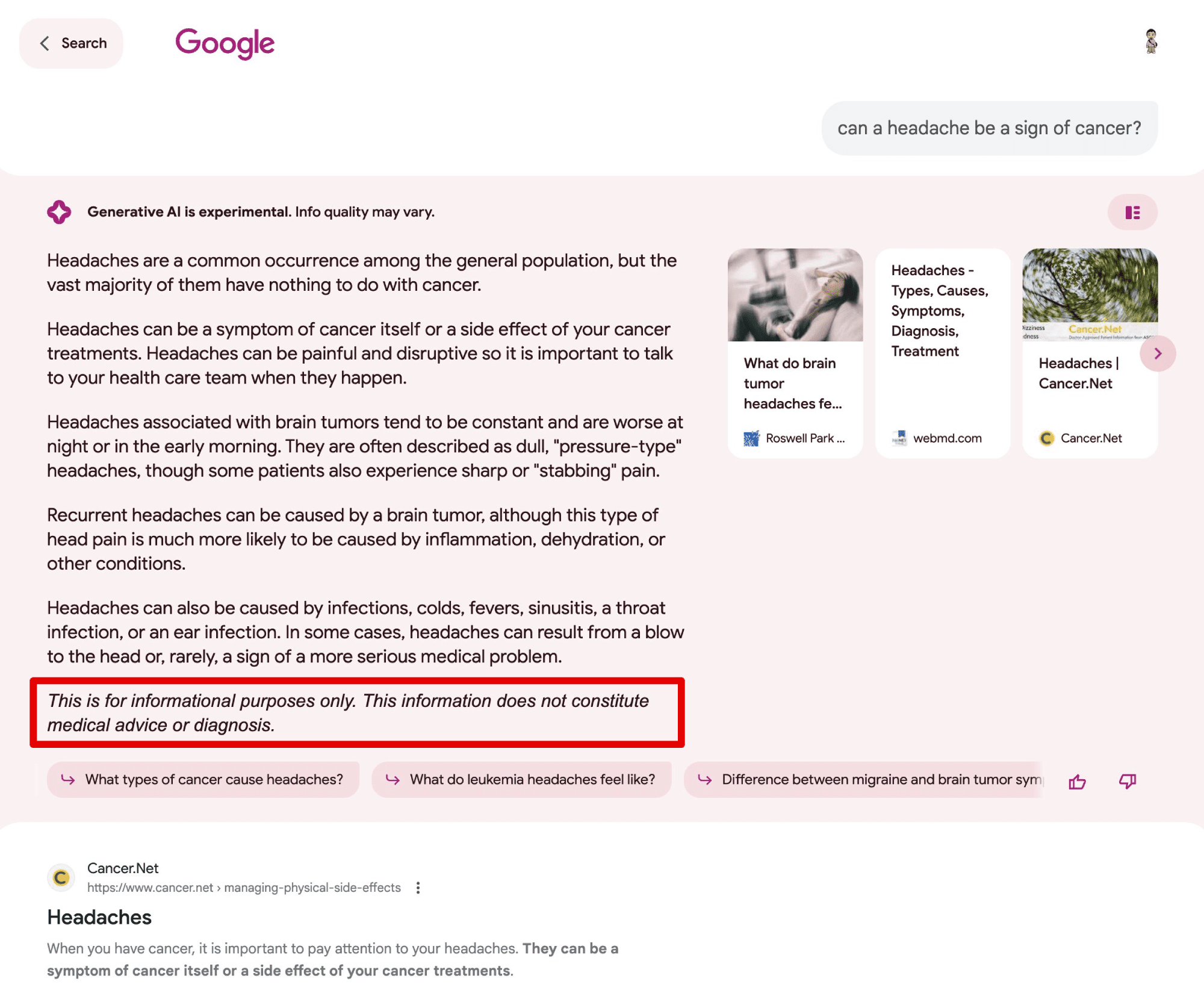 Headaches as a sign of cancer YMYL query in SGE 