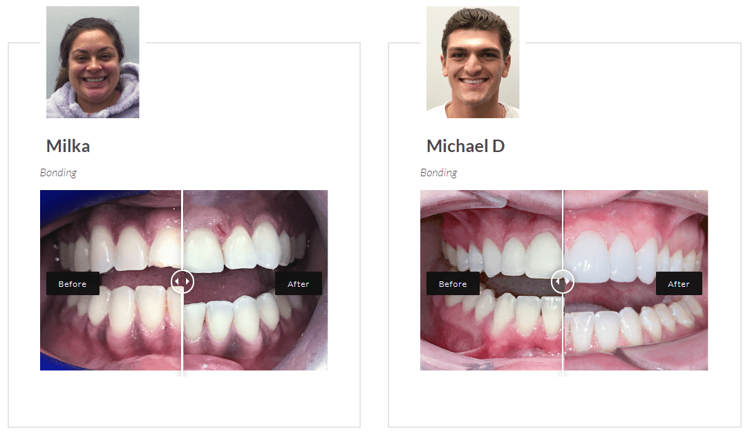 LA Dental Clinic's proof of patients' results