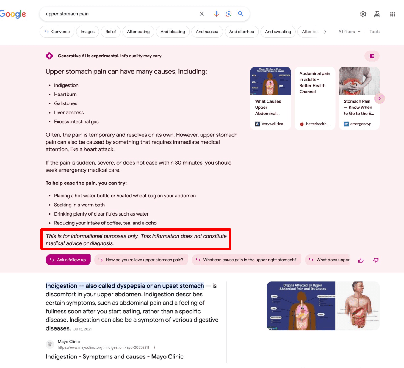 Disclaimers for YMYL queries in Google SGE 