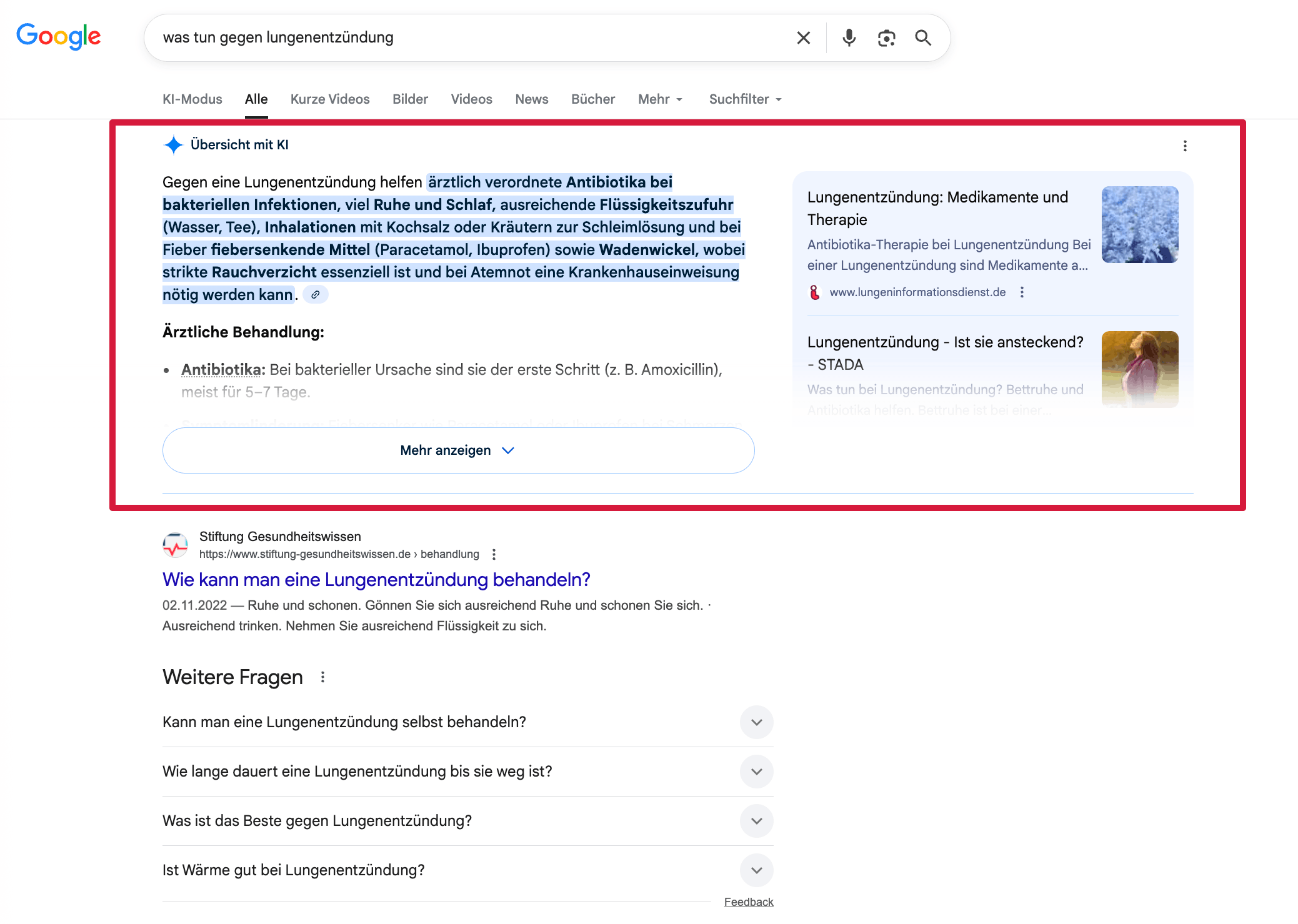 Gesundheitsfrage „Was tun gegen Lungenentzündung?“ in der Google-Suche Frage „Was tun gegen Lungenentzündung?“ in Google