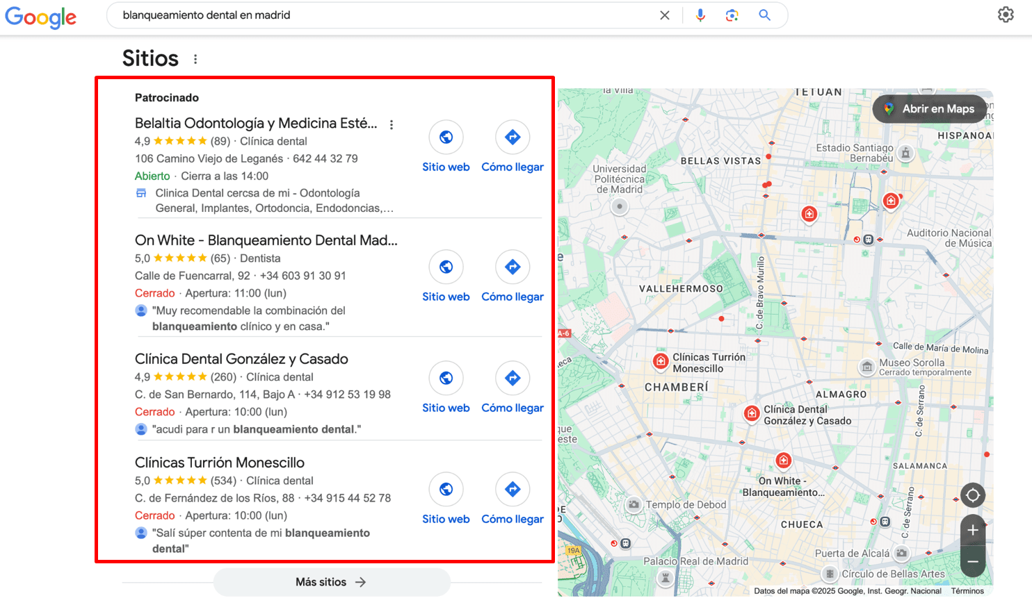 Blanqueamiento dental en madrid consulta de búsqueda