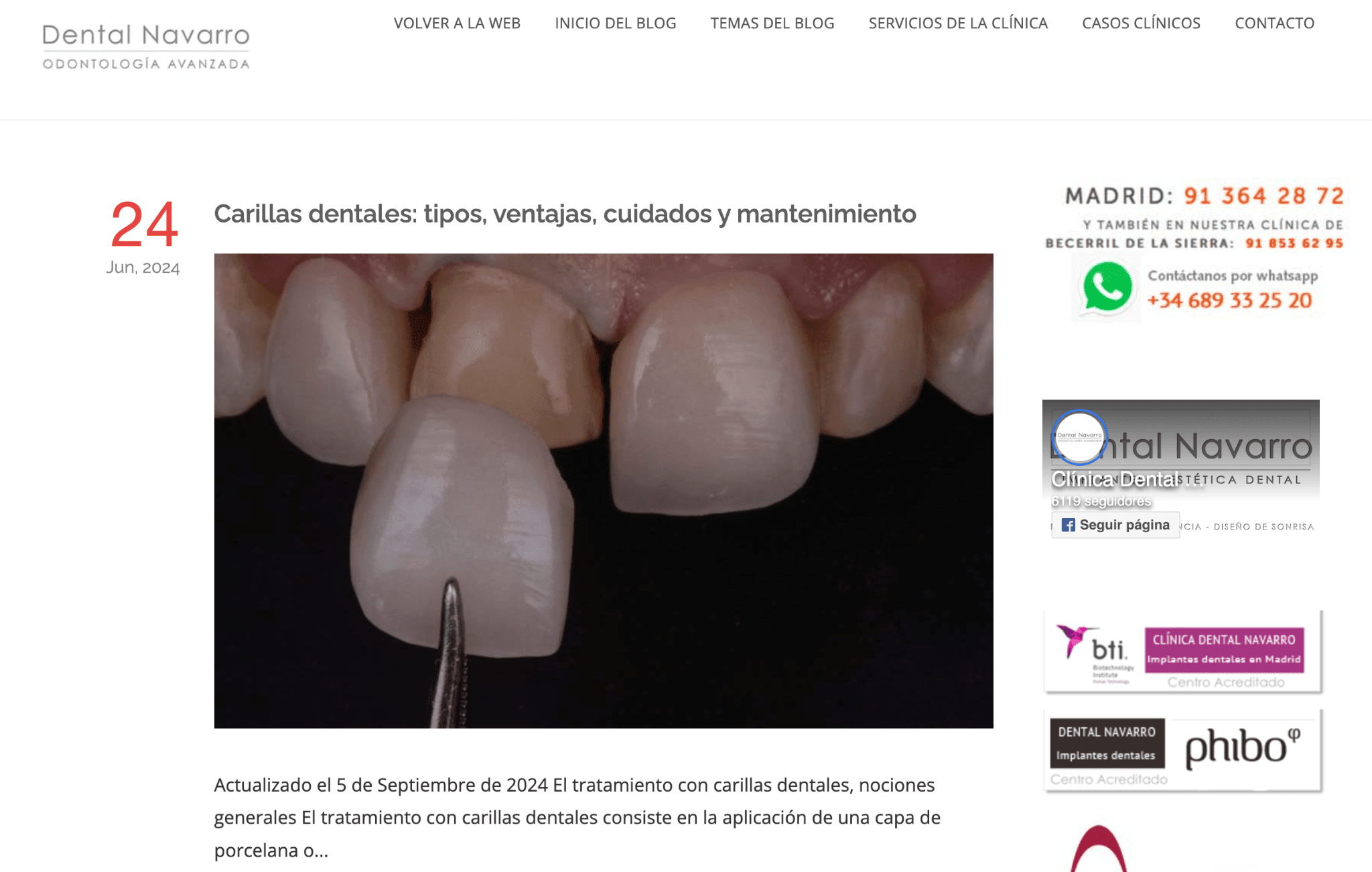 Página de blog de la clínica dental