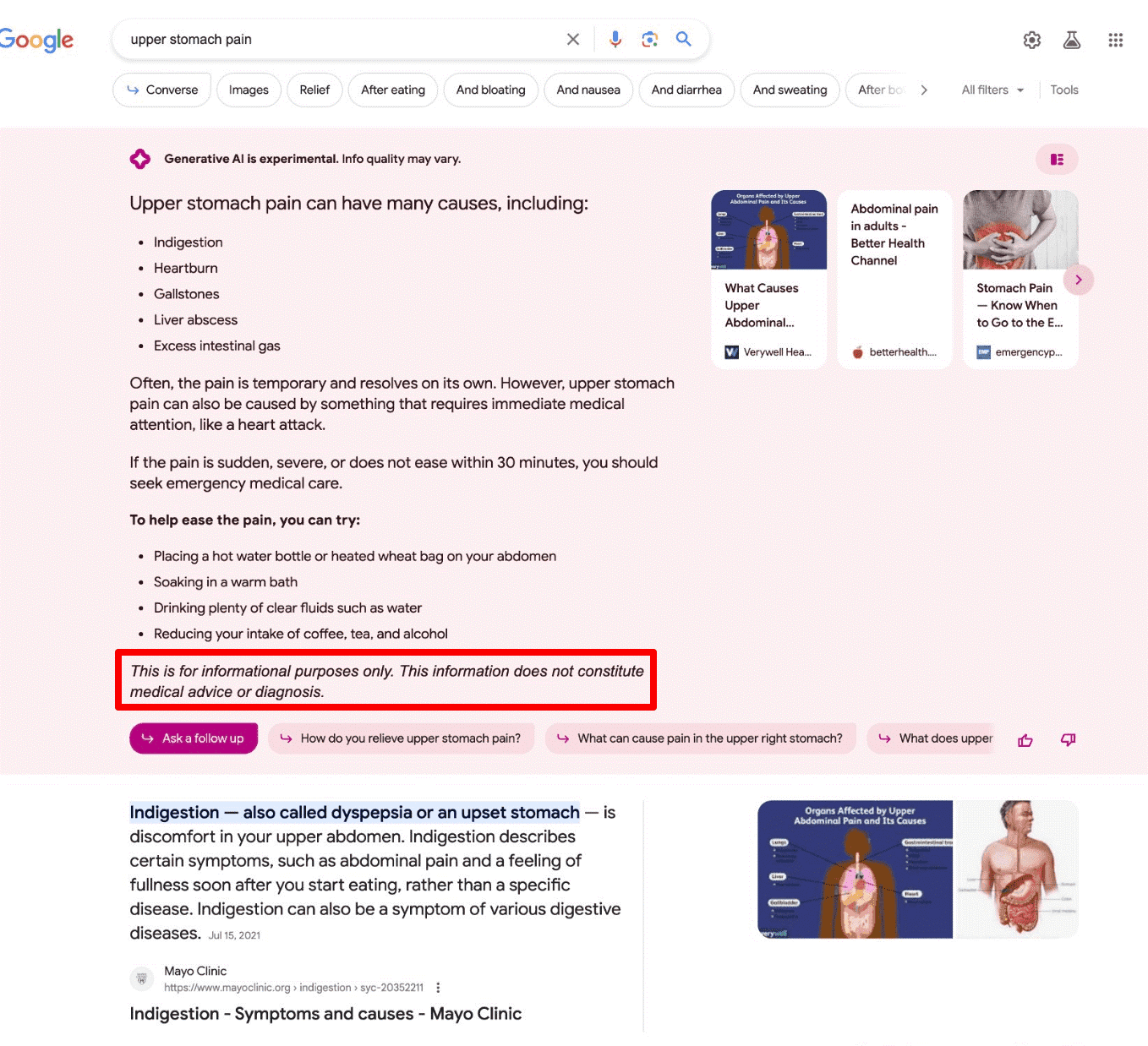 Descargo de responsabilidad por consultas YMYL en Google SGE